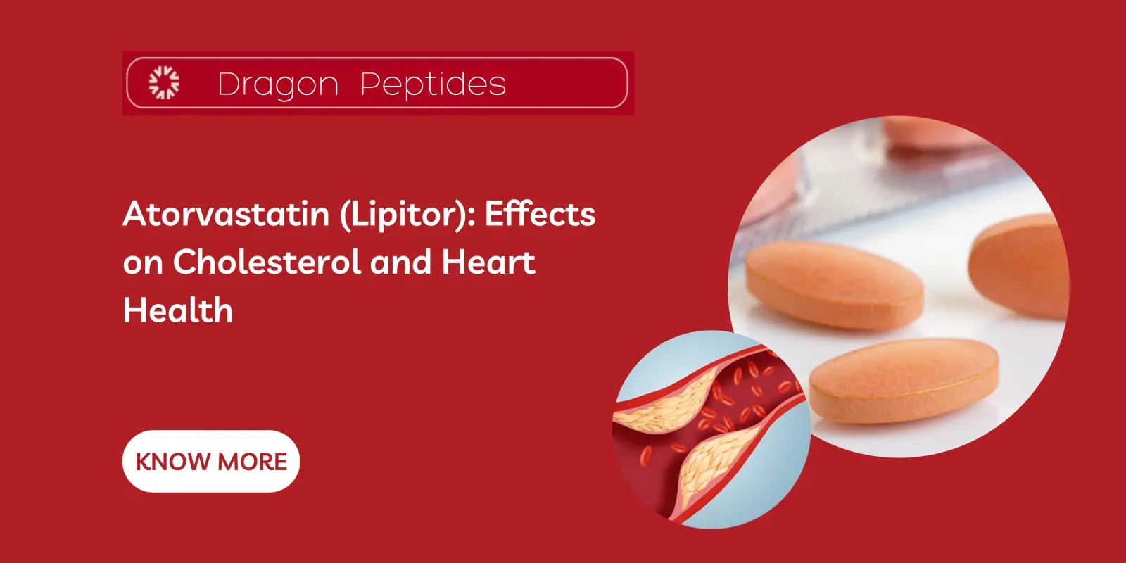 Atorvastatin (Lipitor): Effects on Cholesterol and Heart Health