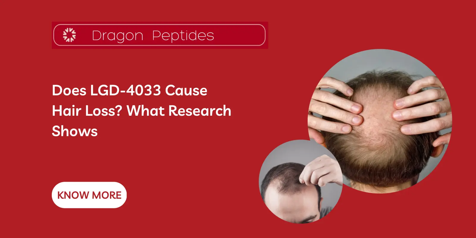 Does LGD-4033 Cause Hair Loss? What Research Shows
